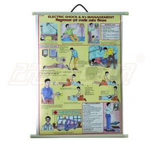 Electric Shock Treatment Chart